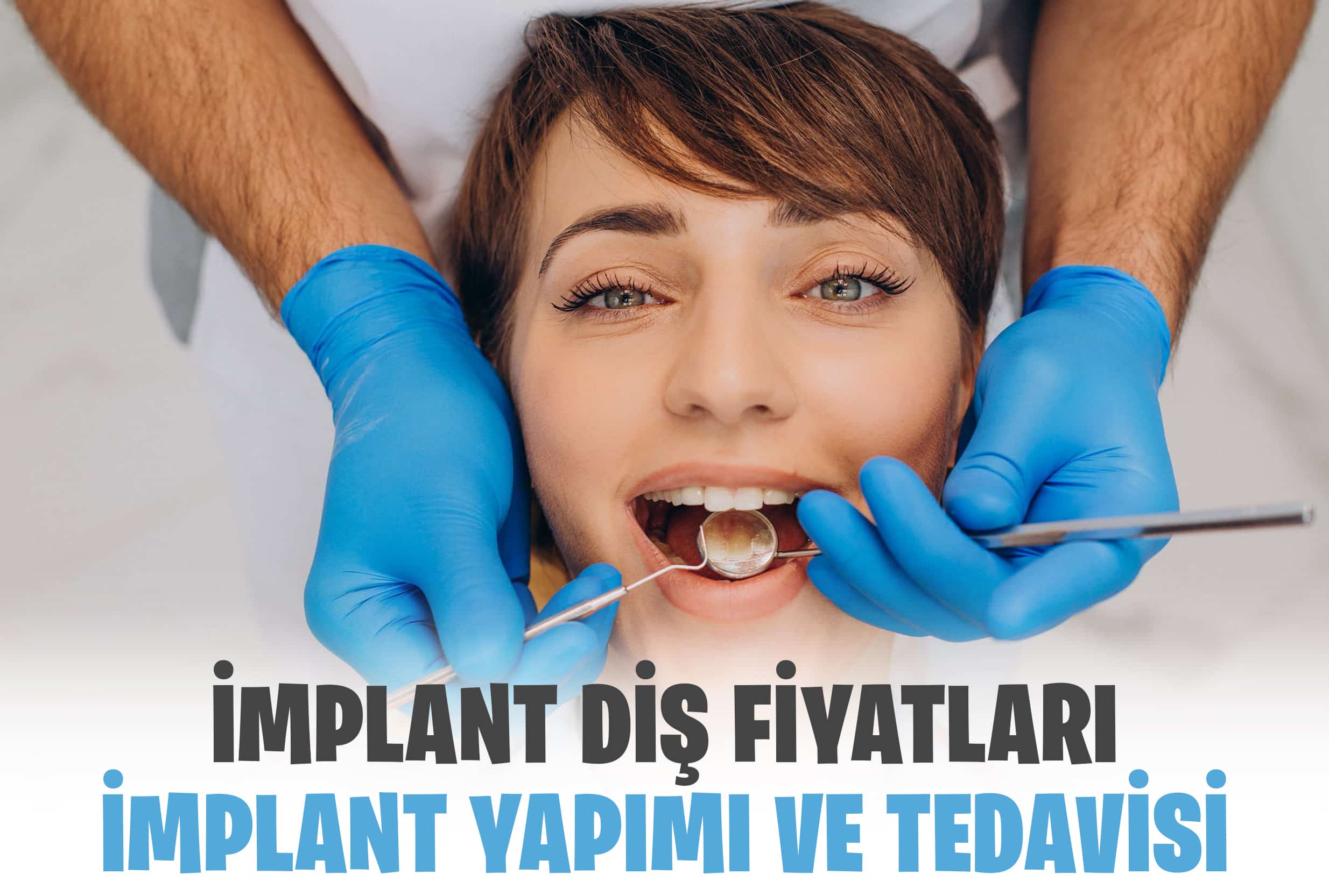 İmplant Fiyatları ve İmplant Diş Yapımı?